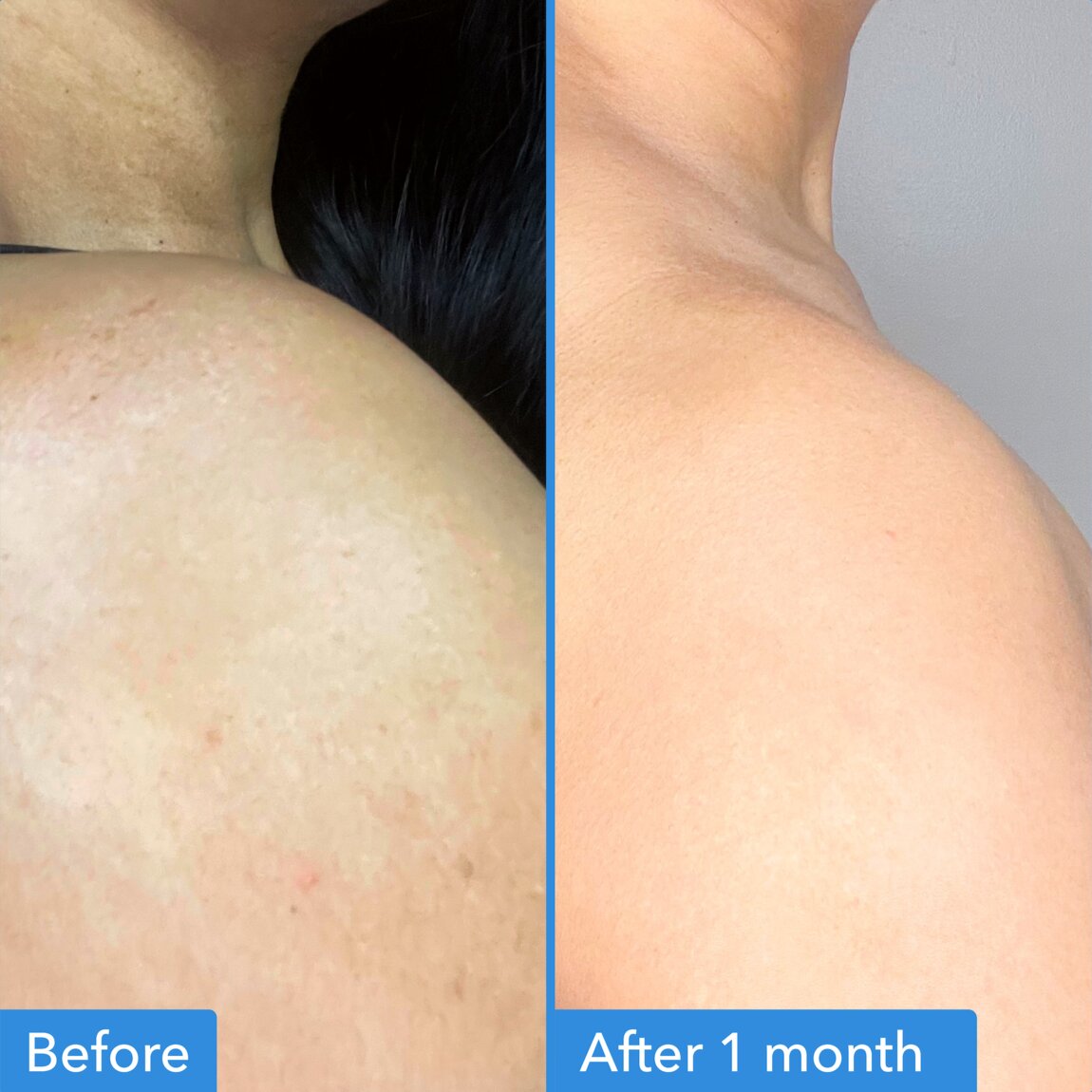 discoloration-correcting-body-treatment-q2 zb_p.jpg