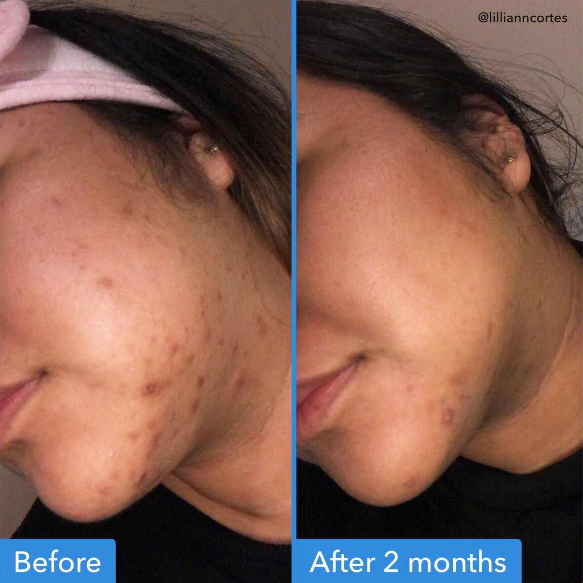 discoloration-correcting-serum-r5 zb_p.jpg